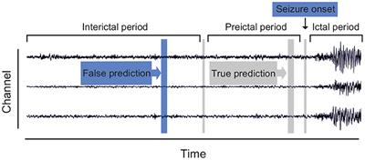 Seizure Prediction in EEG Signals Using STFT and Domain Adaptation